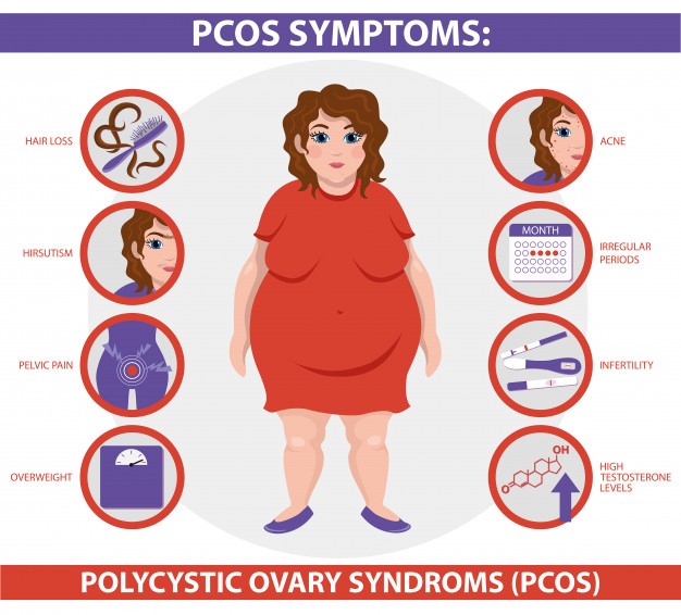 pcos symptoms image